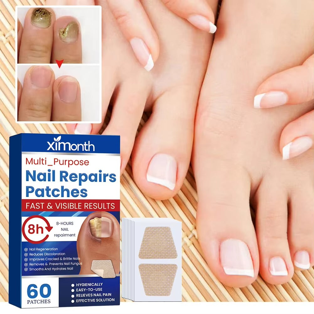 Nail Nurture™ protiplísňové polštářky na opravu nehtů