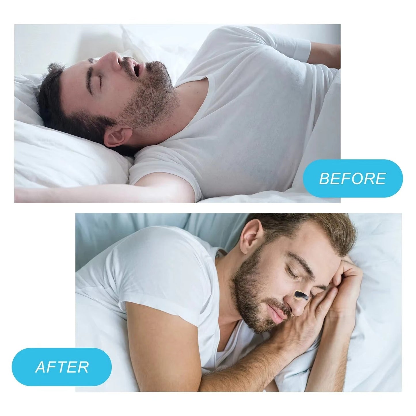 Magnetické prodloužení nosu NoSnore Pro™