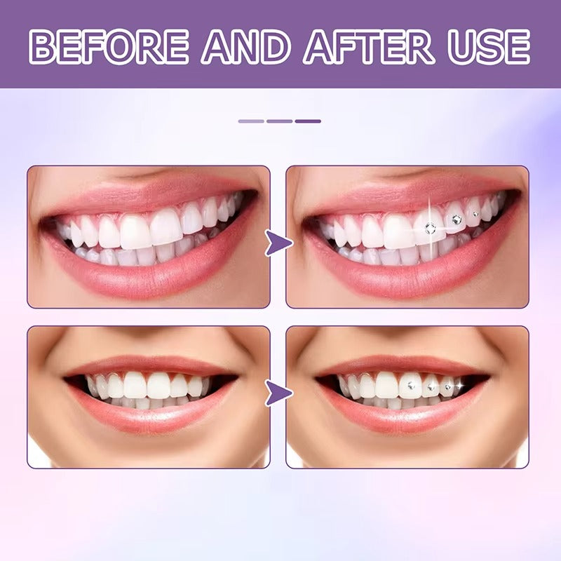 ToothGlam™ Žiar s každým úsmevom