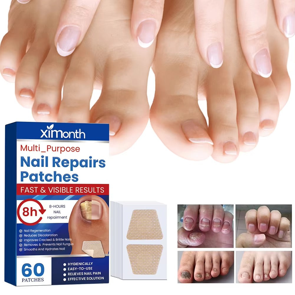 Nail Nurture™ protiplísňové polštářky na opravu nehtů