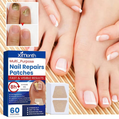 Nail Nurture™ protiplísňové polštářky na opravu nehtů