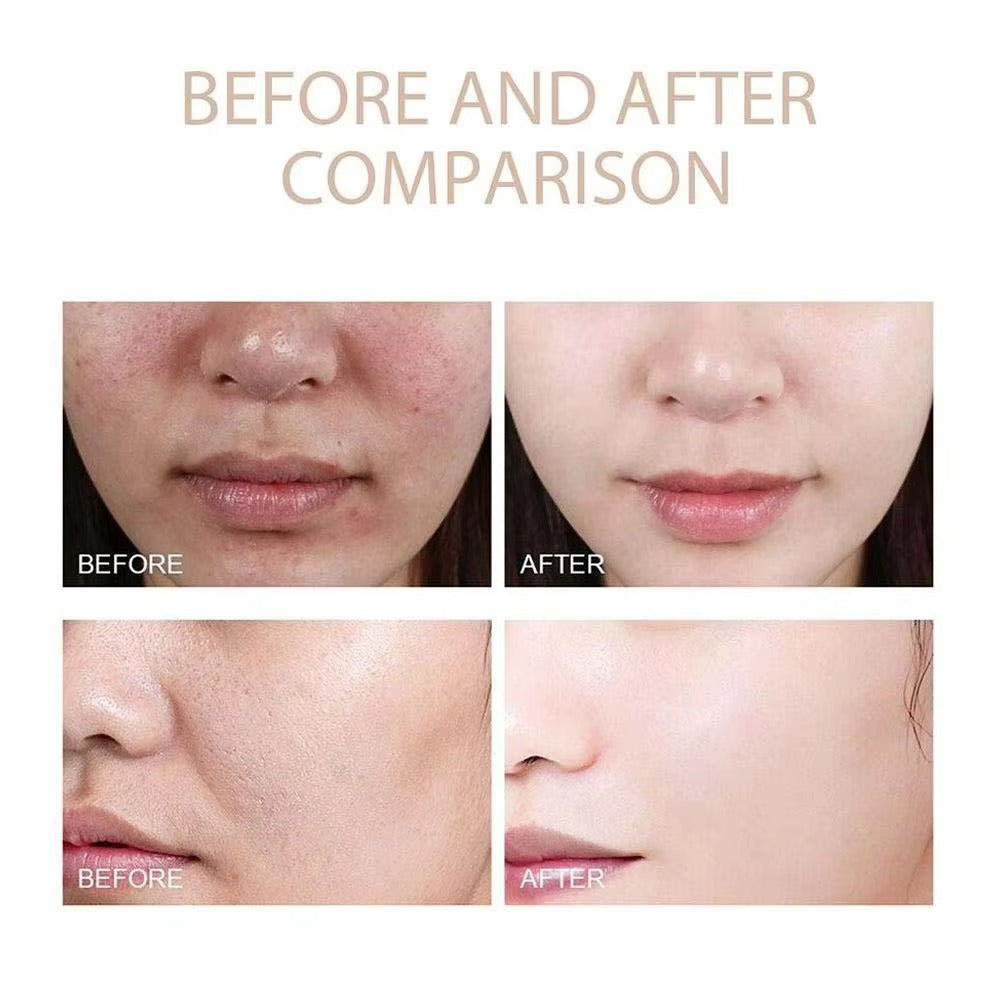 Exfoliačný peeling RadiGlow™
